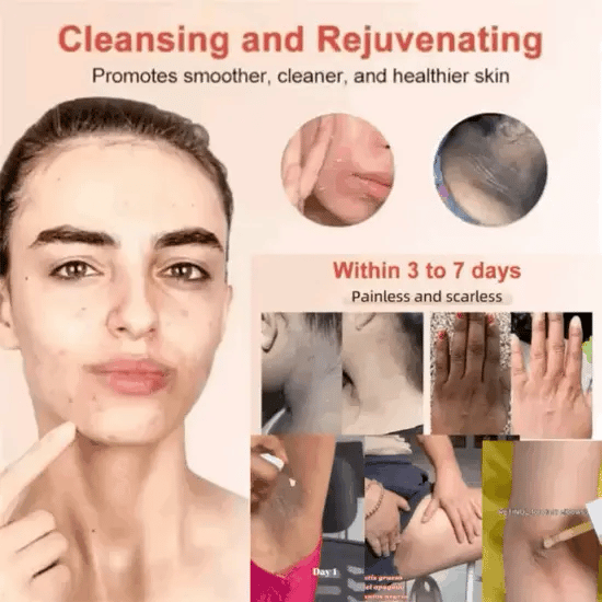 Gel🔥Avanzado Cukita🌺 Piel hermosa coreana, aspecto renovado