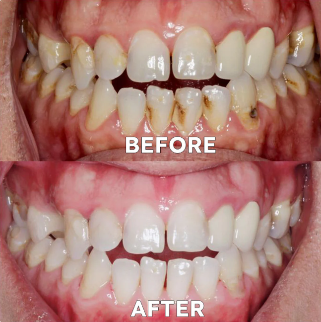 🥰𝗣𝗢𝗟𝗩𝗢 𝗠𝗜𝗡𝗘𝗥𝗔𝗟 - Envío Gratis & Contra Entrega🔥Restaurador