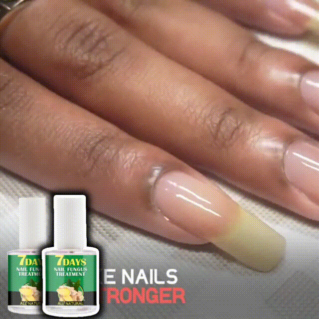 AVANZADO Base Uñas 4K Potente🙅♀️ Crecimiento & Hongos 300% (COMPRA 1 & LLEVA 2)