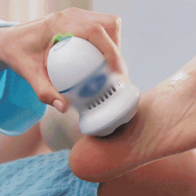 🎁LLEVA EN TU MISMO ENVÍO 🎁 REMOVEDOR DE CALLOS RECARGABLE