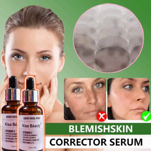 AVANZADO 🎁SUERO DE PIEL - Quita Manchas Rostro - Enrojecimientos - Excesos⭐⭐⭐⭐⭐UPSELL