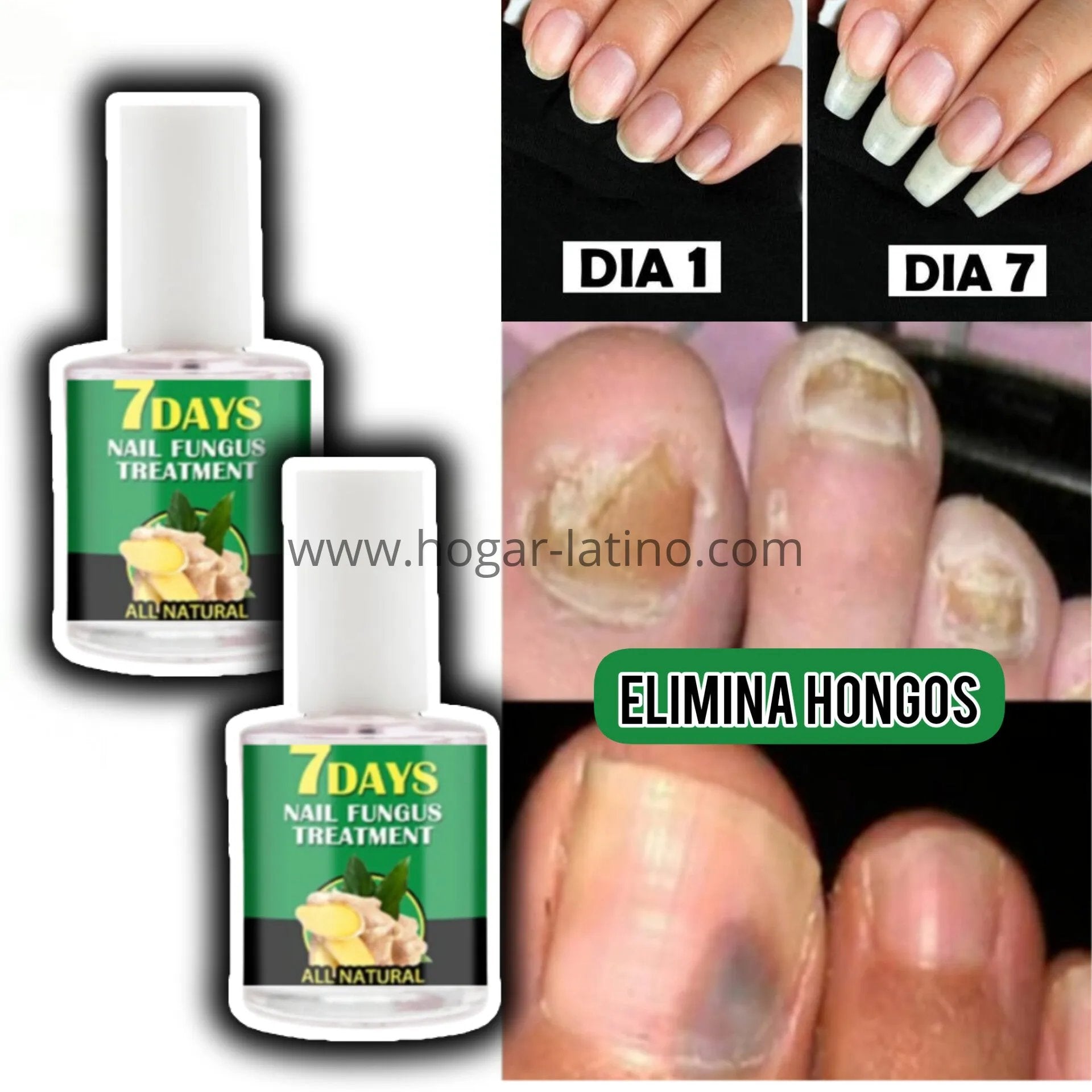 Base Uñas 4K Potente🙅♀️ Crecimiento & Hongos AVANZADO 300% (COMPRA 1 & LLEVA 2)