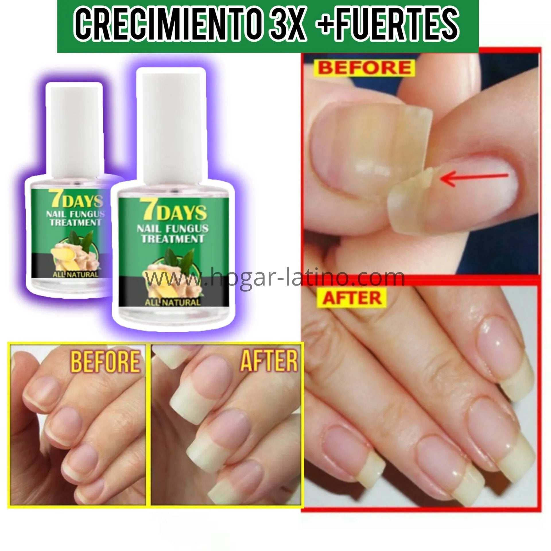 Base Uñas 4K Potente🙅♀️ Crecimiento & Hongos AVANZADO 300% (COMPRA 1 & LLEVA 2)