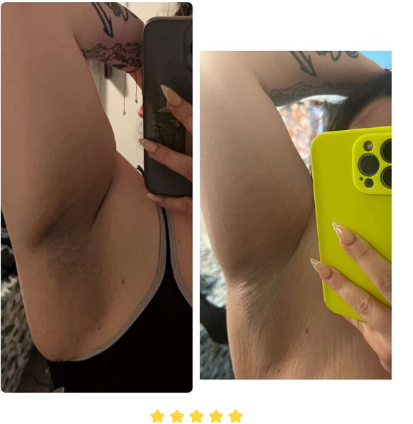 USO 14 DÍAS❗Serum Manchitas Cuerpo ⭐⭐⭐⭐⭐❗[ENVÍO GRATIS] 🎁