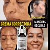 USO 14 DÍAS❗Serum Manchitas Cuerpo ⭐⭐⭐⭐⭐❗[ENVÍO GRATIS] 🎁