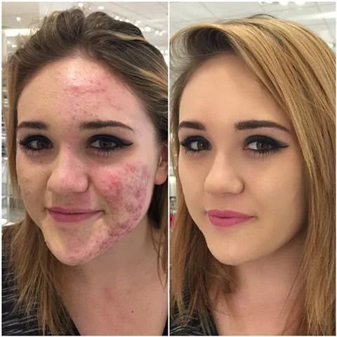 300 % VELVET TOUCH ®- Base Líquida - FIRMEZA⭐⭐⭐⭐⭐WOMEN