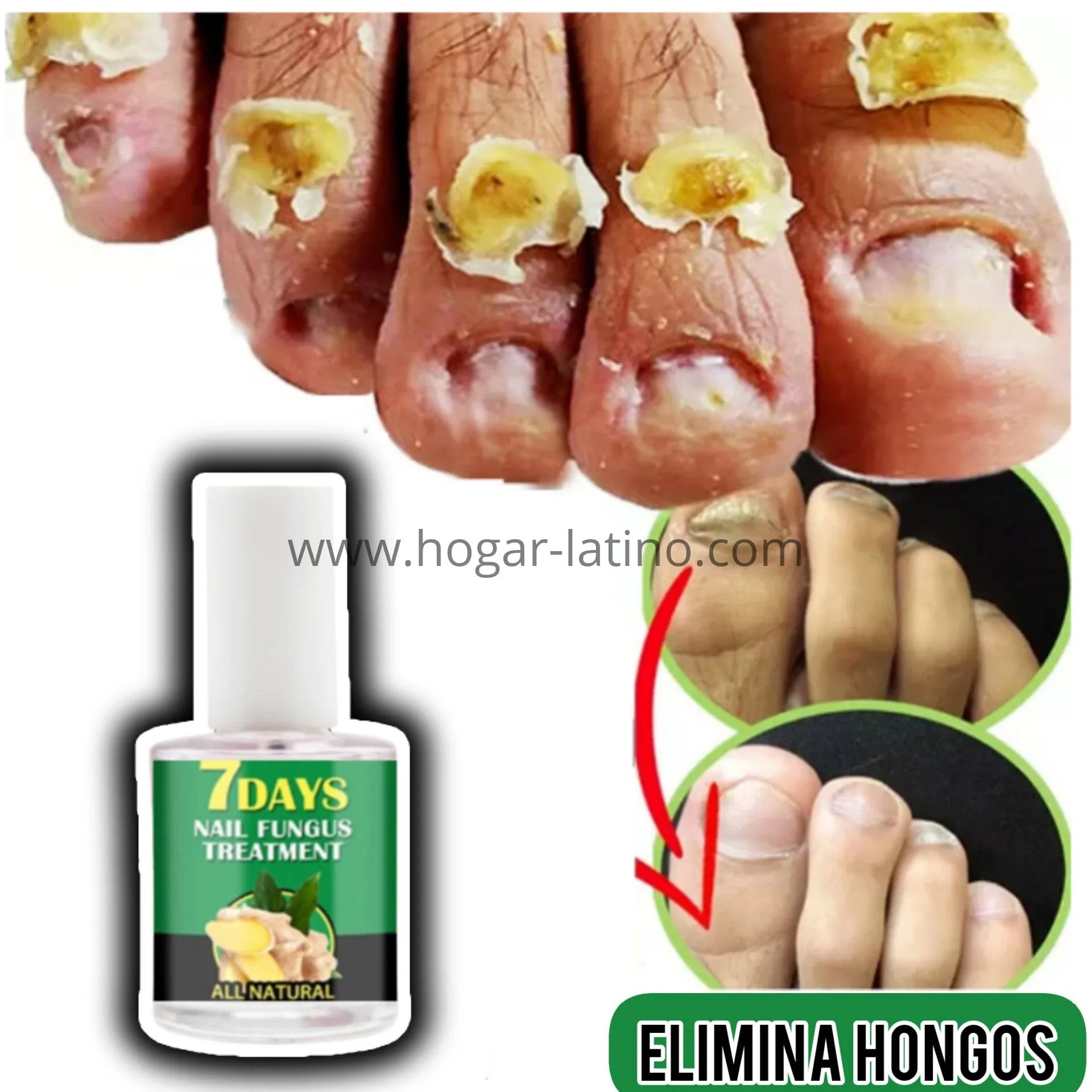 AVANZADO Base Uñas 4K Potente🙅‍♀️ Crecimiento & Hongos 300% (COMPRA 1 & LLEVA 2)